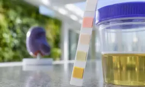 Urinprov med teststicka och mugg. En modell av en njure syns i bakgrunden, relevant för att undersöka protein i urin gravid.