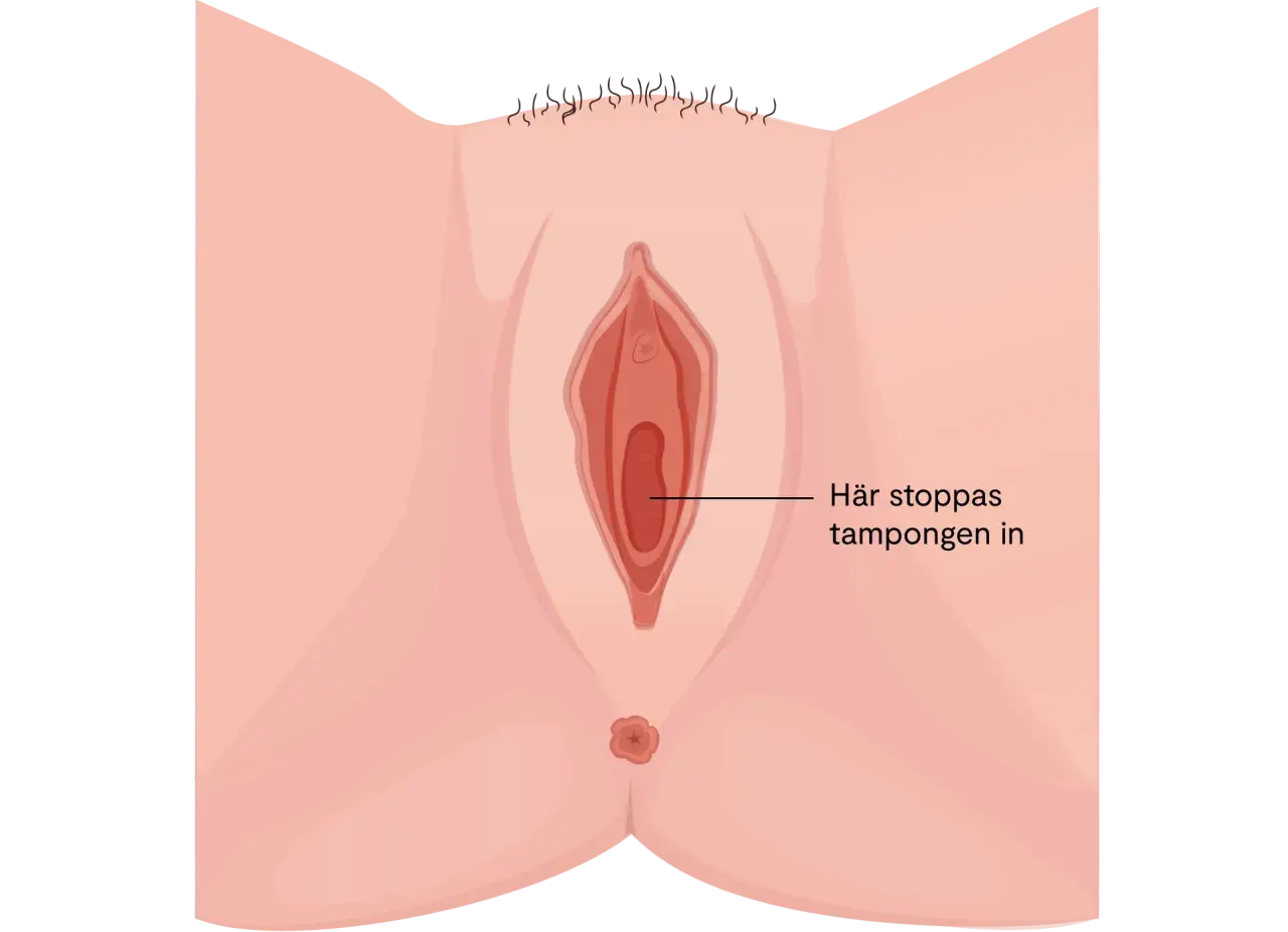 Illustration av en kvinnas underliv. En pil pekar in i vaginan med texten "Här stoppas tampongen in". Kan vara relevant vid diskussion om svamp i underlivet gravid.