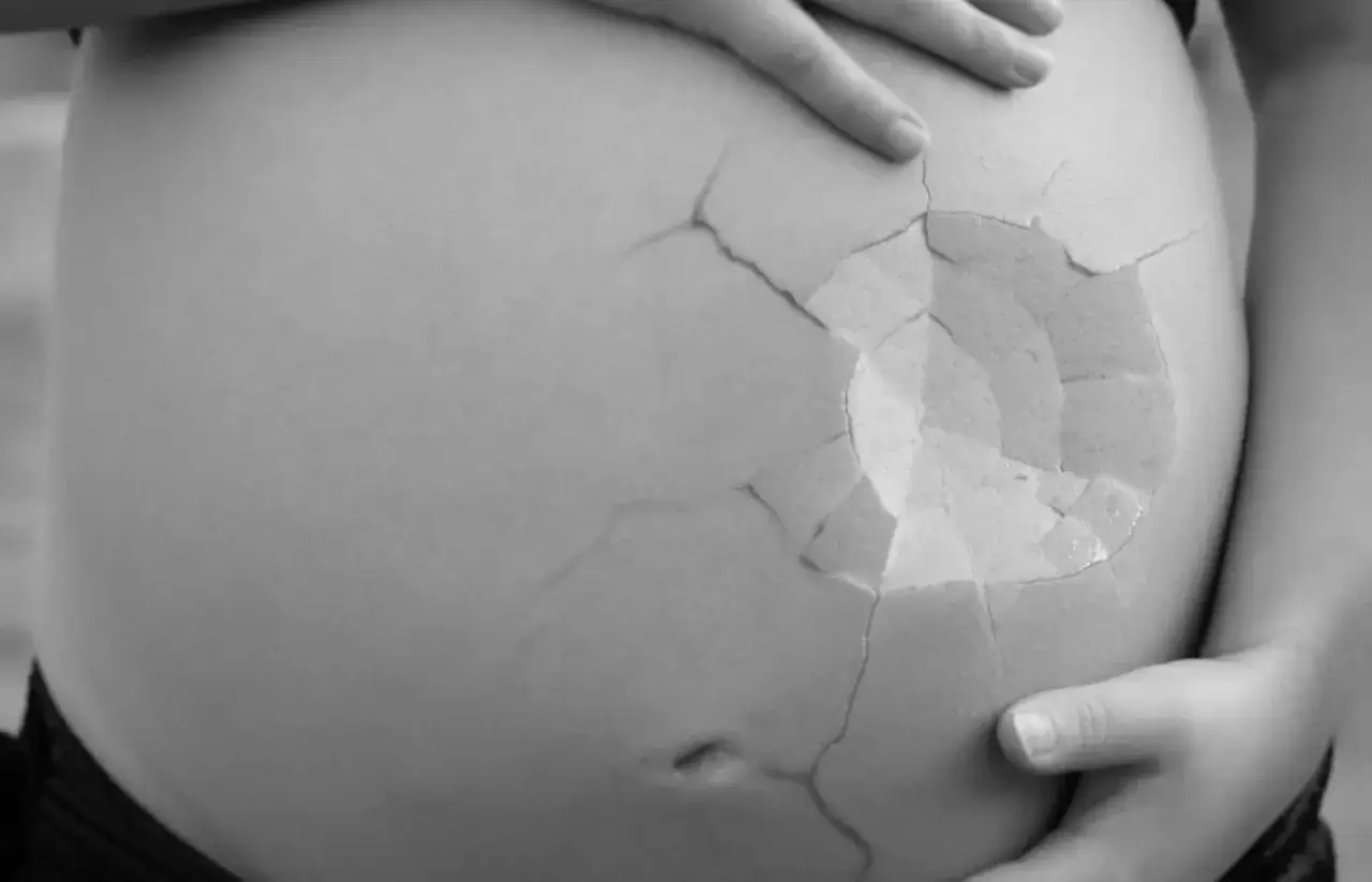 En gravid mage med sprickor som ett äggskal. En symbol för ett missfall vecka 11.