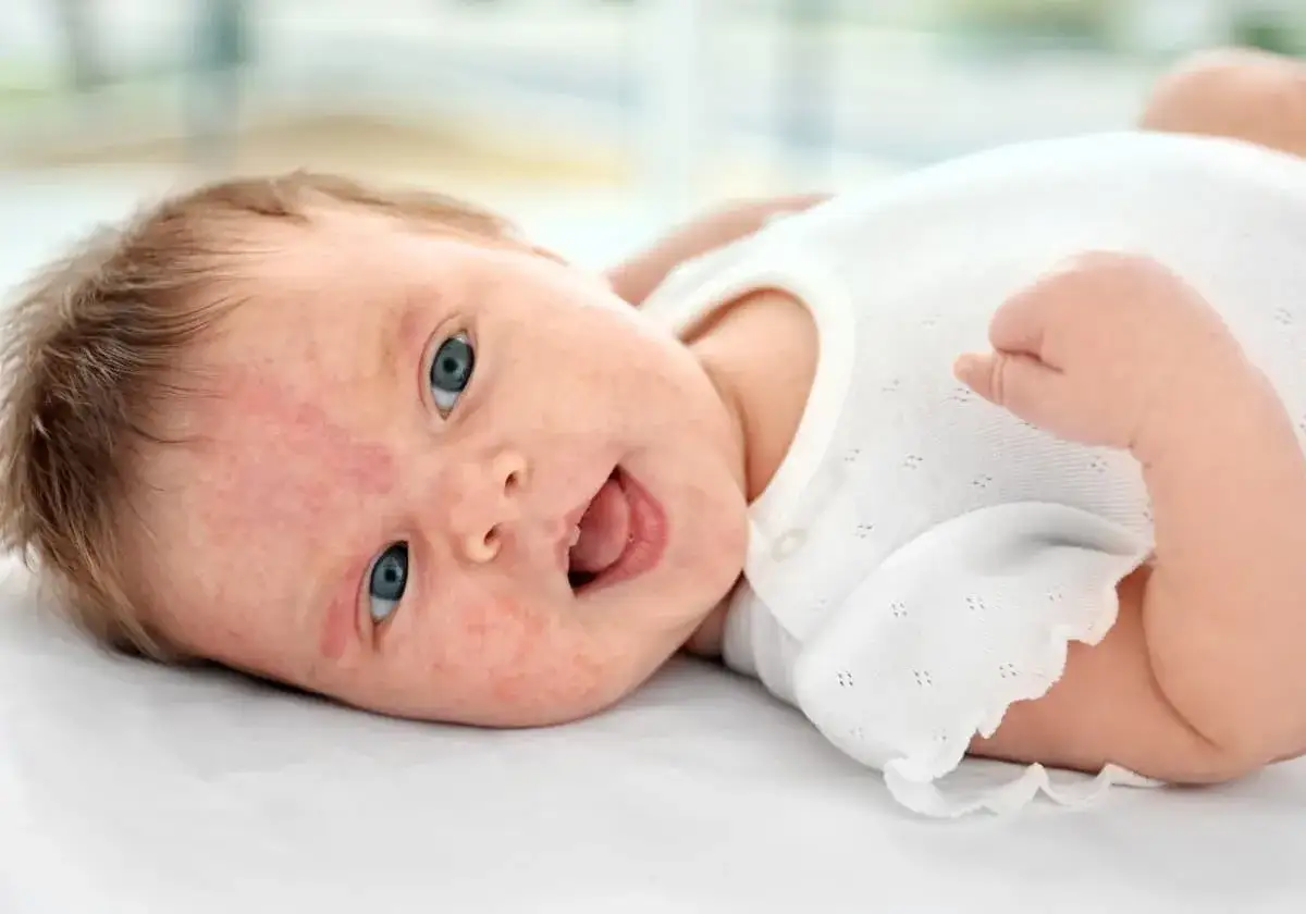 S&ouml;t bebis med bl&aring; &ouml;gon och lite hormonplitor p&aring; kinderna, glad och leende.